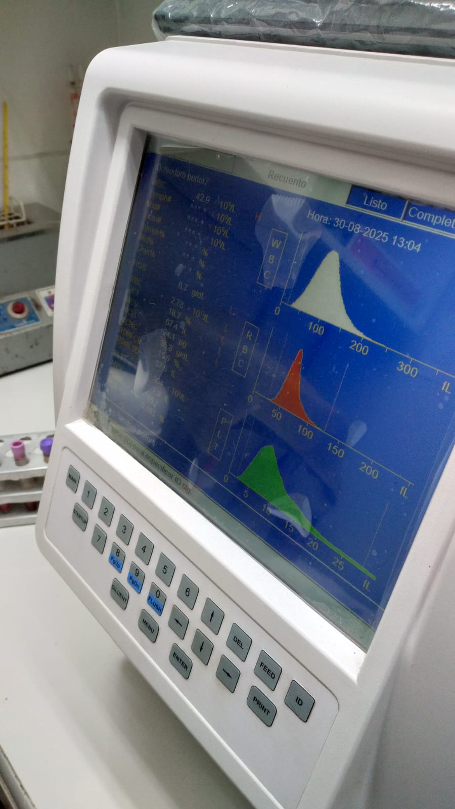 Analizador hematológico en proceso de recuento